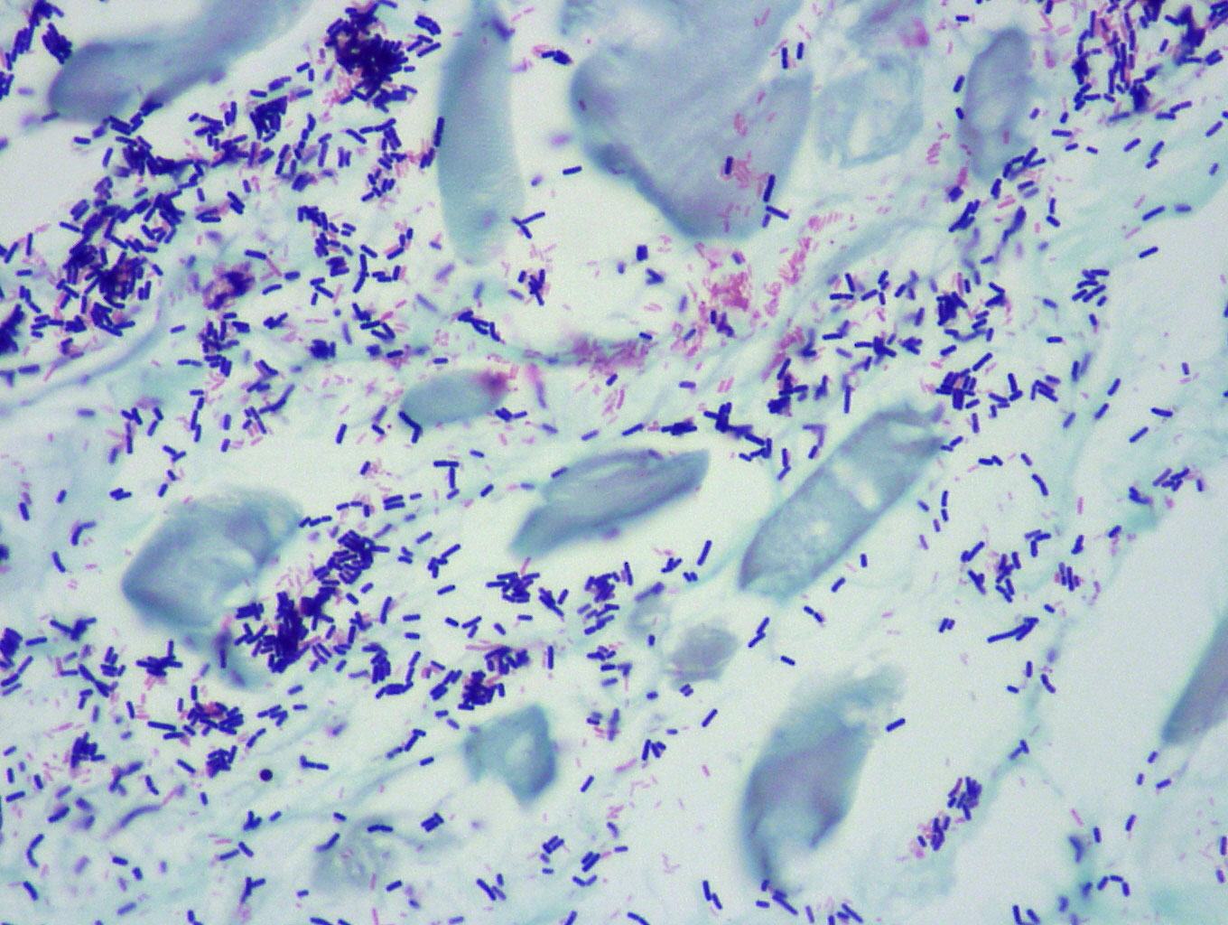 Gram positive and negative staining